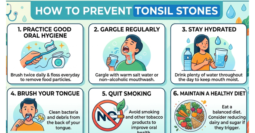 How to Prevent Tonsil Stones: Effective Tips